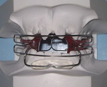  Centro dental Ortodoncia Mar De Grado activador 2