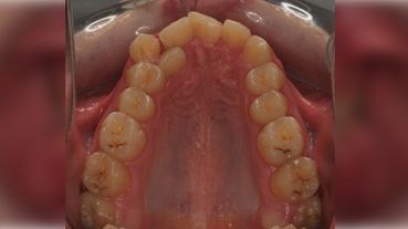Centro dental Ortodoncia Mar De Grado antes 2