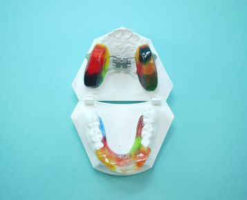  Centro dental Ortodoncia Mar De Grado twin block 3