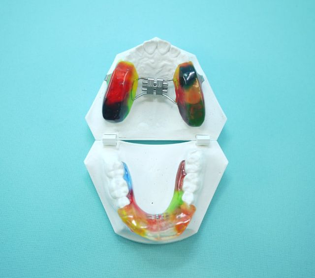  Centro dental Ortodoncia Mar De Grado twin block 3