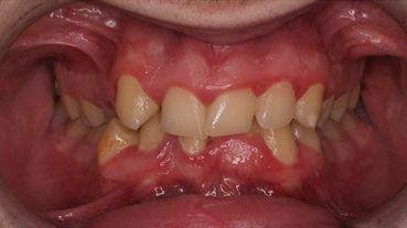 Centro dental Ortodoncia Mar De Grado antes 1