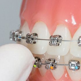 brackets autoligado