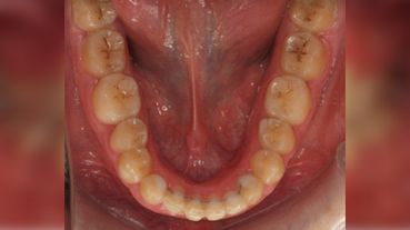 Centro dental Ortodoncia Mar De Grado después 3
