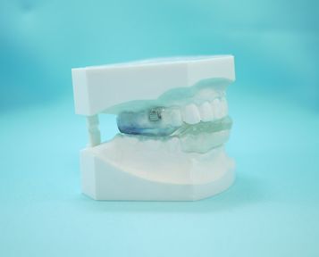  Centro dental Ortodoncia Mar De Grado perfil molde mandíbula