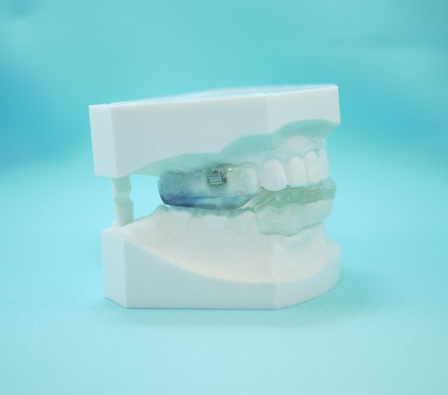  Centro dental Ortodoncia Mar De Grado perfil molde mandíbula