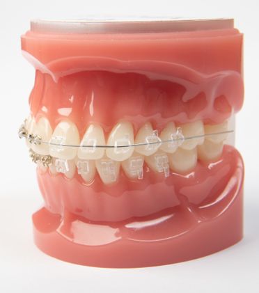 brackets transparentes