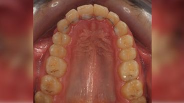 Centro dental Ortodoncia Mar De Grado después 2