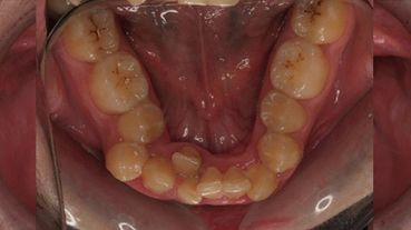 Centro dental Ortodoncia Mar De Grado antes 3