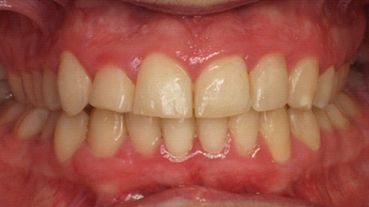 Centro dental Ortodoncia Mar De Grado después 1