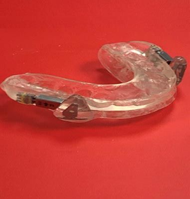 foto dam,dispositivo de avance mandibular,D.A.M,apnea del sueño